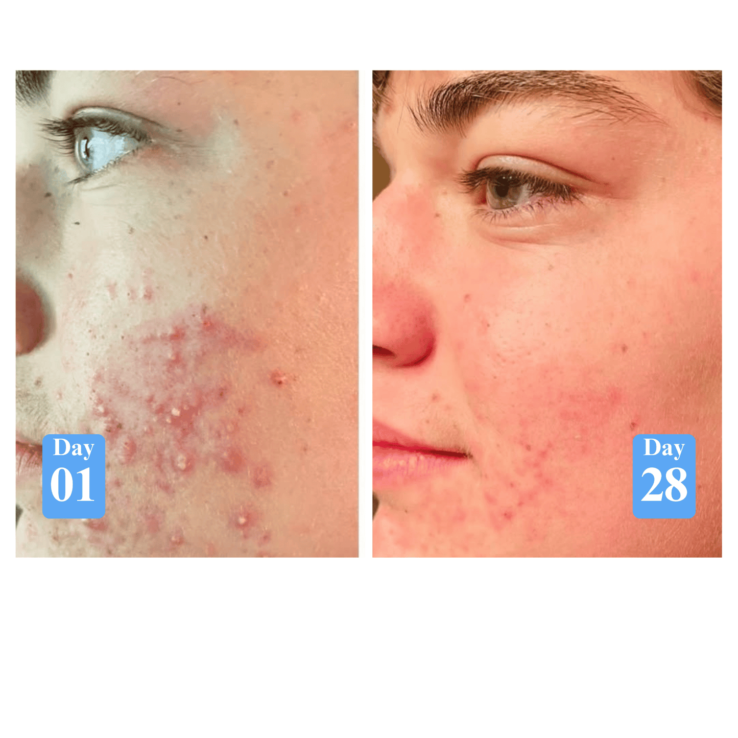 (GHK-Cu) Copper Peptides + Hyaluronic Acid Serum